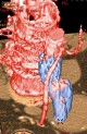 Bifurcated aortic stent graft for infrarenal abdominal aortic aneurysm
